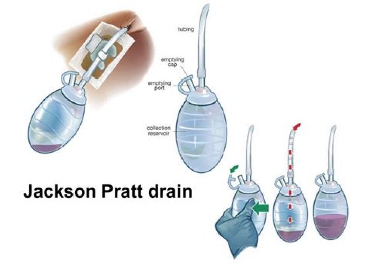 What is a jackson pratt drain?