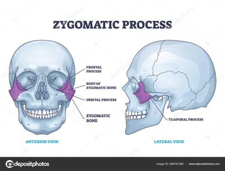 What is a zygomatic process?