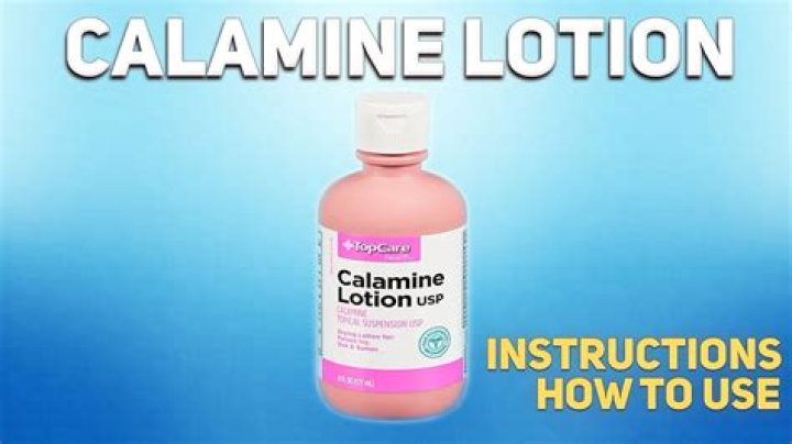 What is calamine lotion used to treat?