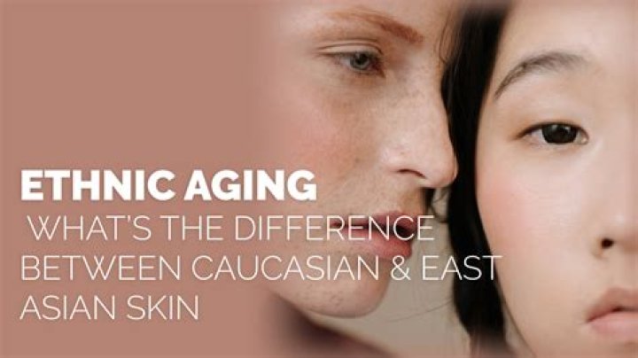 What is caucasian skin?