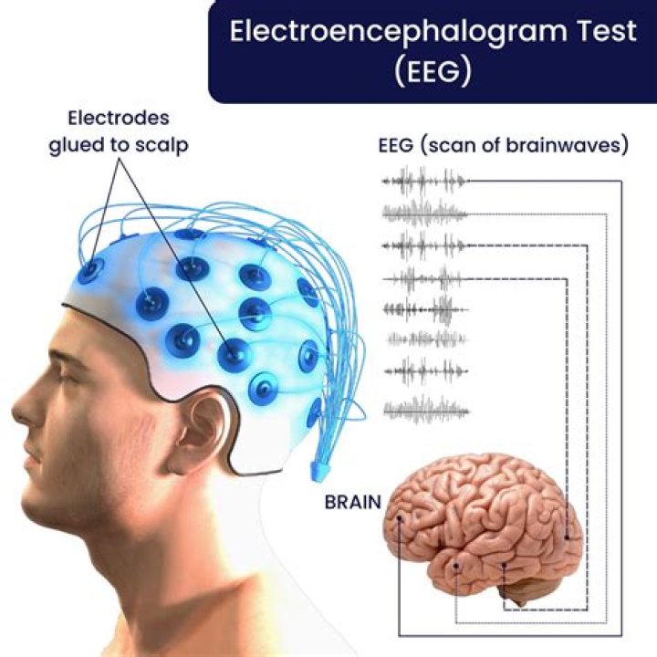What is electroencephalography quizlet?
