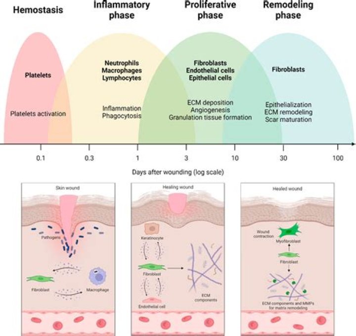What is epidermal proliferation?