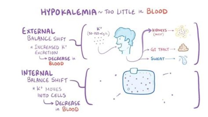 What is hypokalemic alkalosis?
