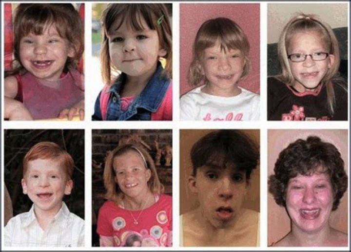 What is koolen-de vries syndrome?