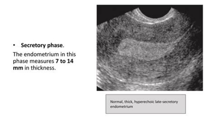 What is secretory endometrium?