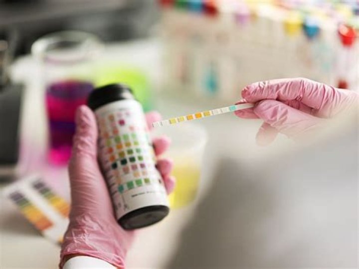 What is the medical term for prostatolith?