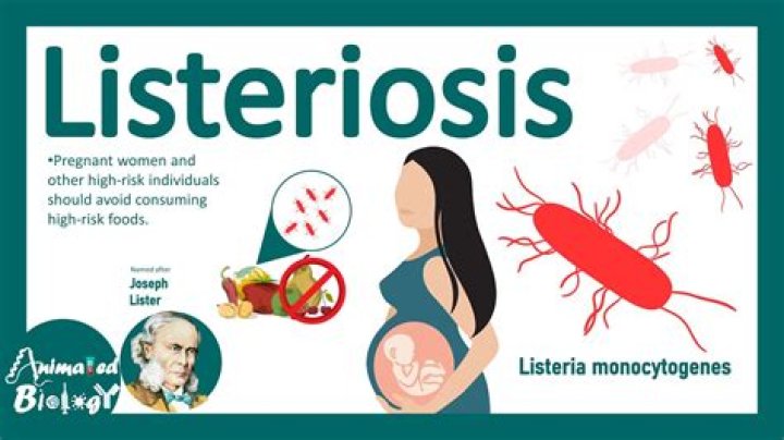 What is the treatment for listeriosis?