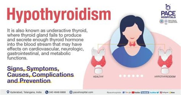 What tsh level is hypothyroidism?