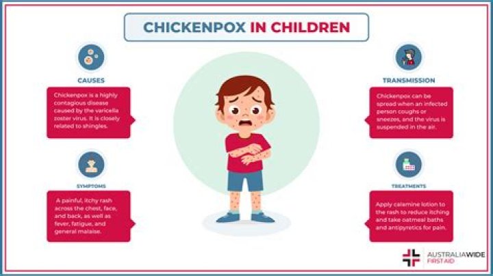 When are chickenpox itchiest?