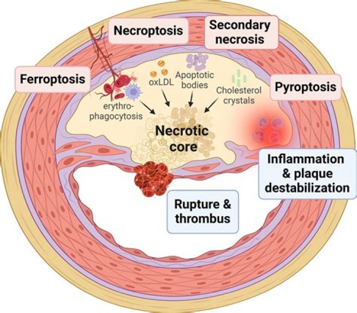 When does necrosis occur?