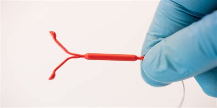 When to check iud strings?