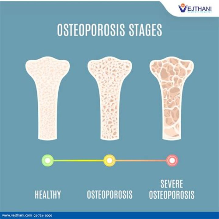 When was osteopetrosis found?