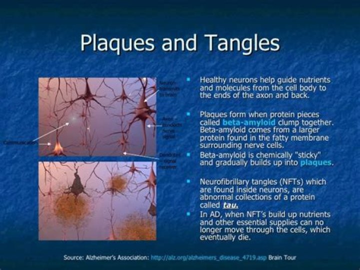 Where are plaques and tangles found?
