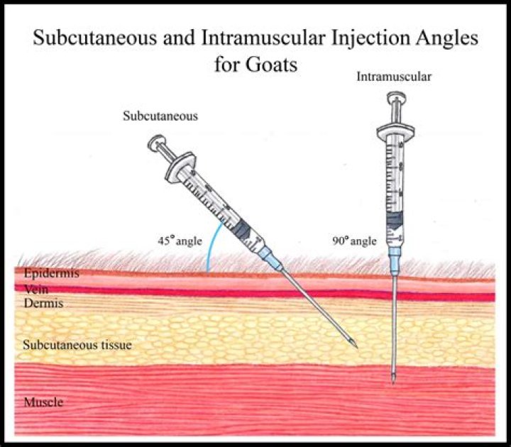 Where intramuscular injection sites?