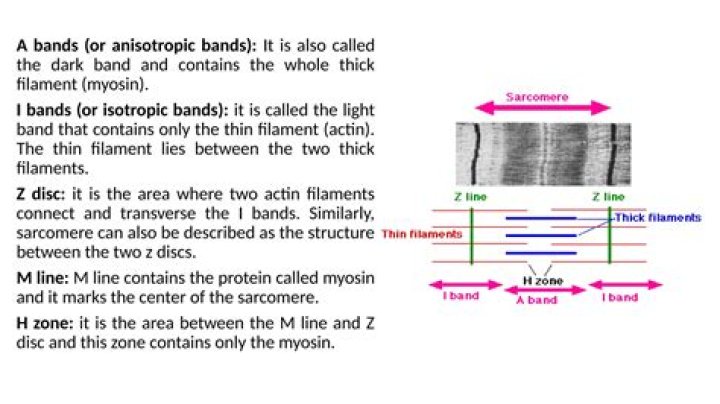 Where is the anisotropic band?