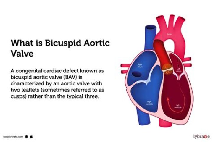 Where is the bicuspid valve located in the heart?