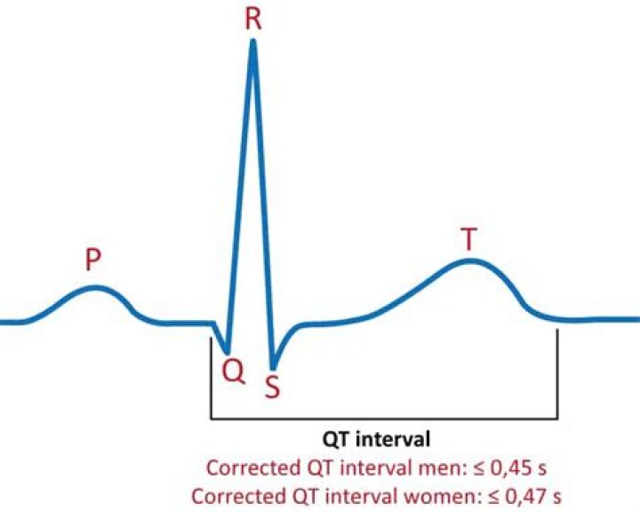 Where is the qt interval?