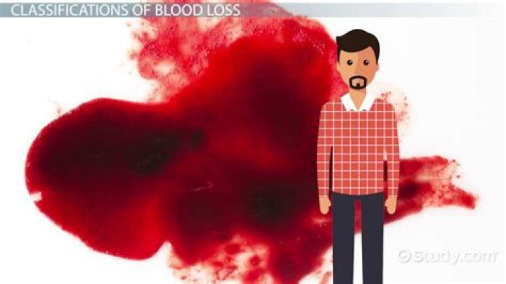 Where to squeeze nose bleed?