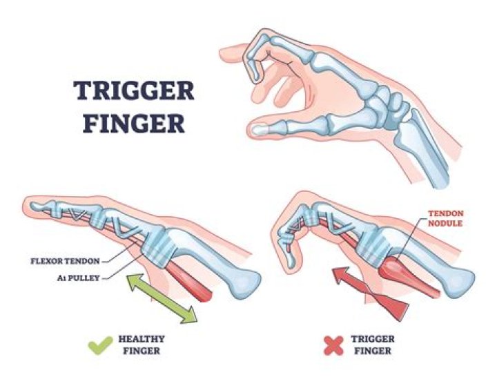 Which finger is the trigger finger?