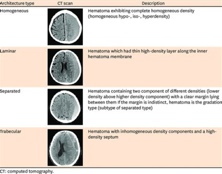 Which hematoma is worse?