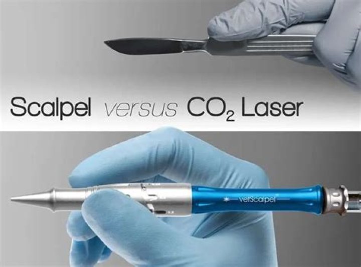 Which is better scalpel or laser?