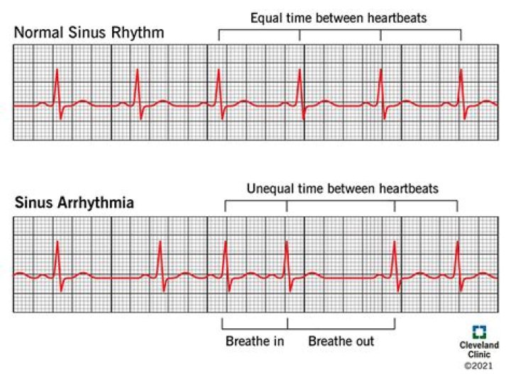 Which is respiratory rhythm?