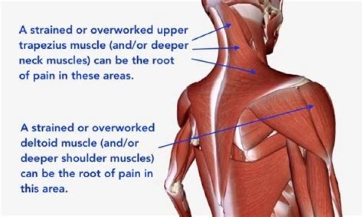 Which muscle hyperextends the neck?