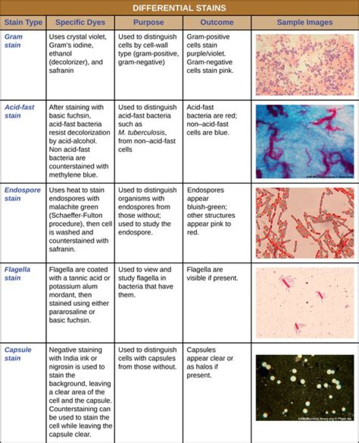 Which of the following is/are differential stains)?