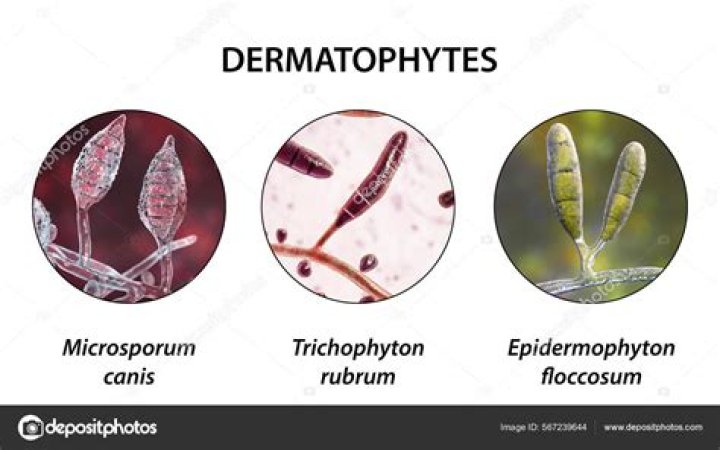 Which of the following structures is invaded by the genus trichophyton?
