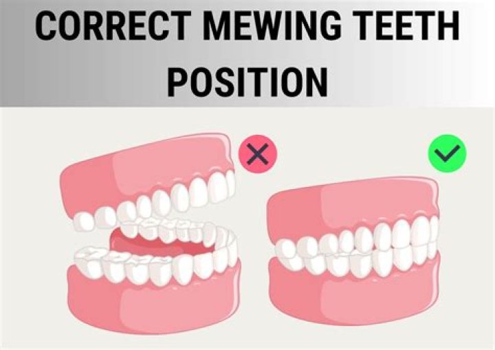 Which teeth should touch when mewing?