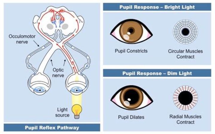 Which term refers to constriction of the pupil of the eye?