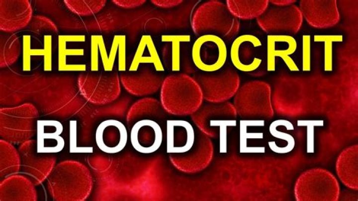 Who does hematocrit test?