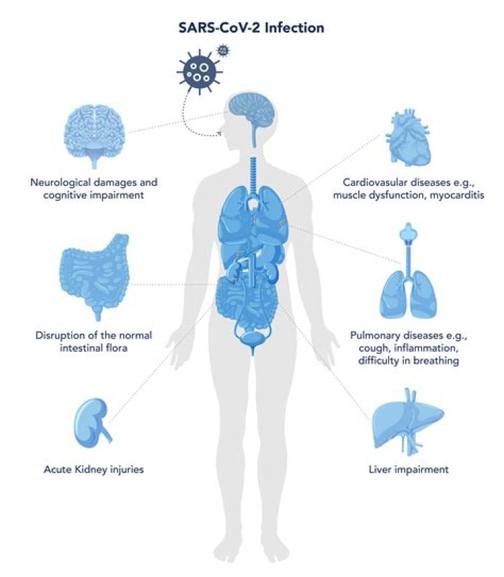 Who gets complications from covid?