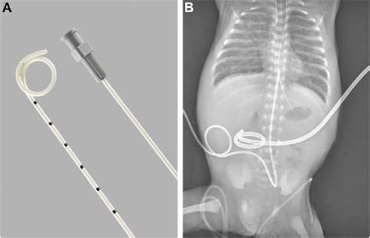 Why carmit left pcd?