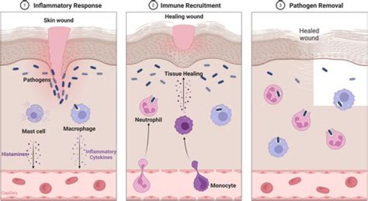 Why do cancerous tissues require angiogenesis?