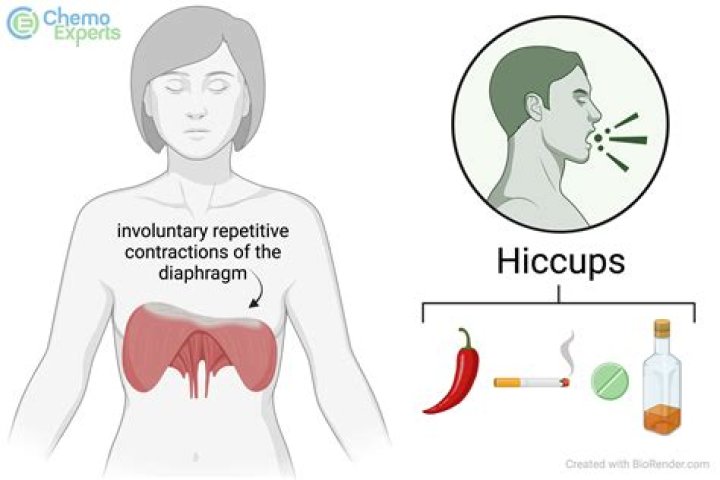 Why do hiccups happen randomly?