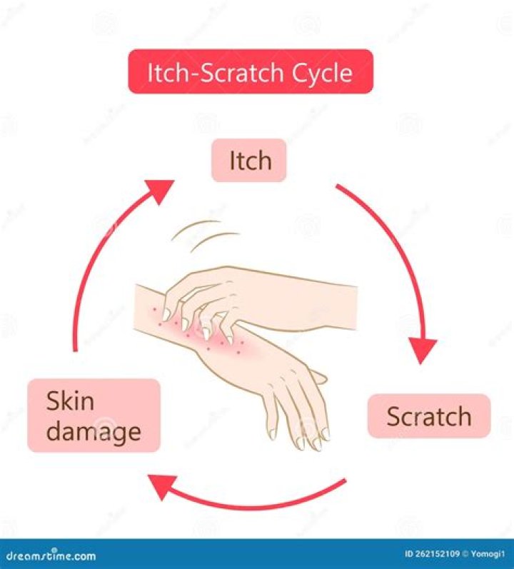 Why do scratches itch?