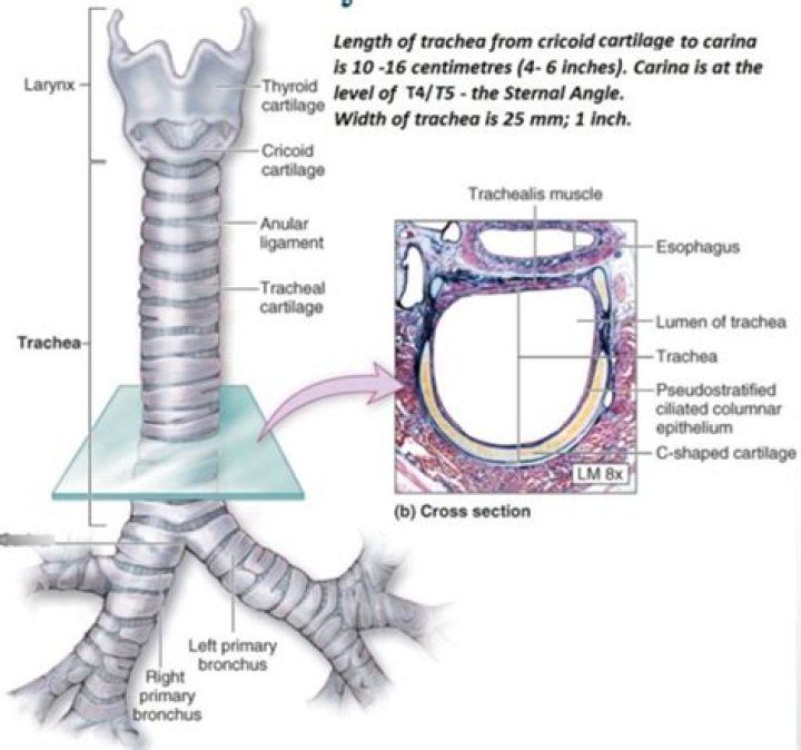 Why does my cricoid cartilage hurt?
