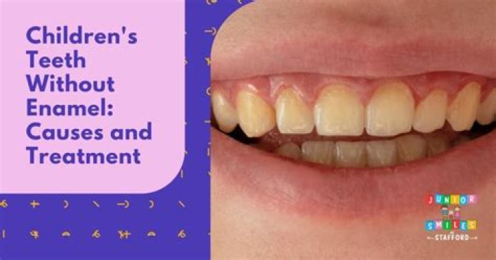 Why enamel comes off teeth?