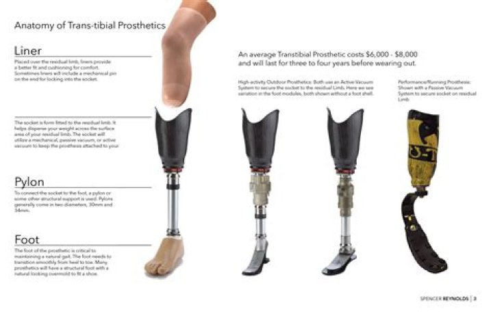 Why is prosthesis important?
