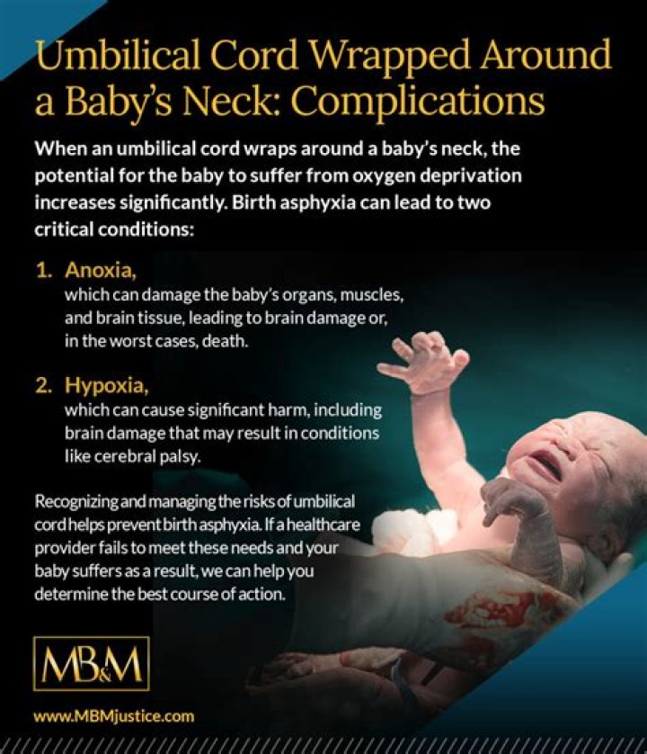 Why umbilical cord wrapped around neck?