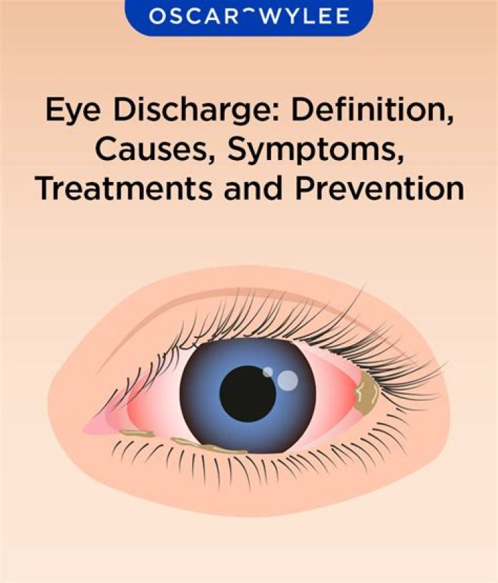 Why white discharge from eyes?