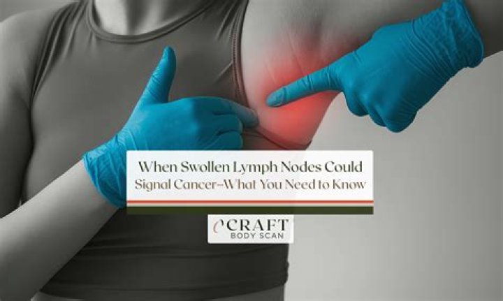 Will a cancerous lymph node grow?