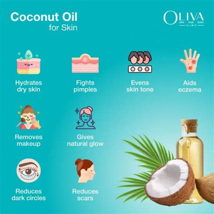 Will coconut oil help acne?