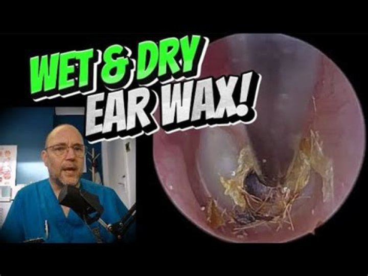 Will softened ear wax fall out?