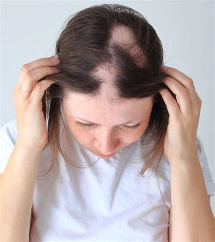 Will trichotillomania hair grow back?