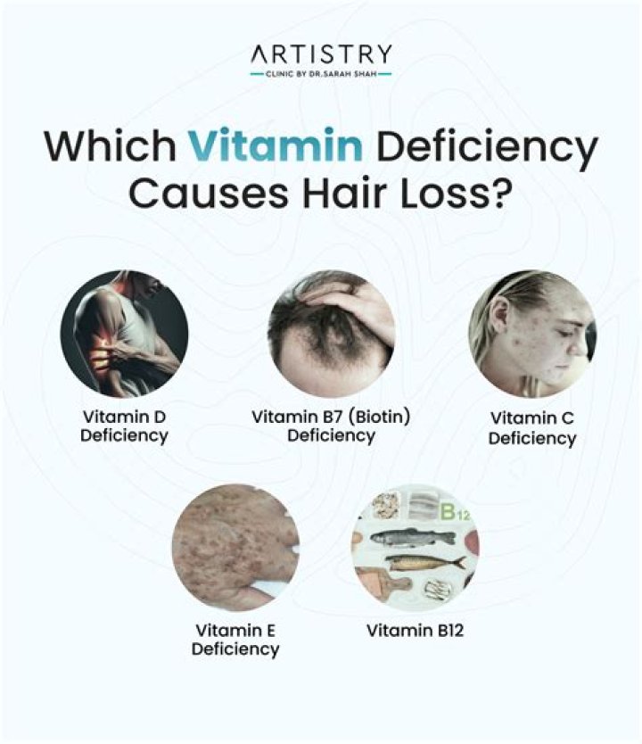 Would vitamin d deficiency cause hair loss?